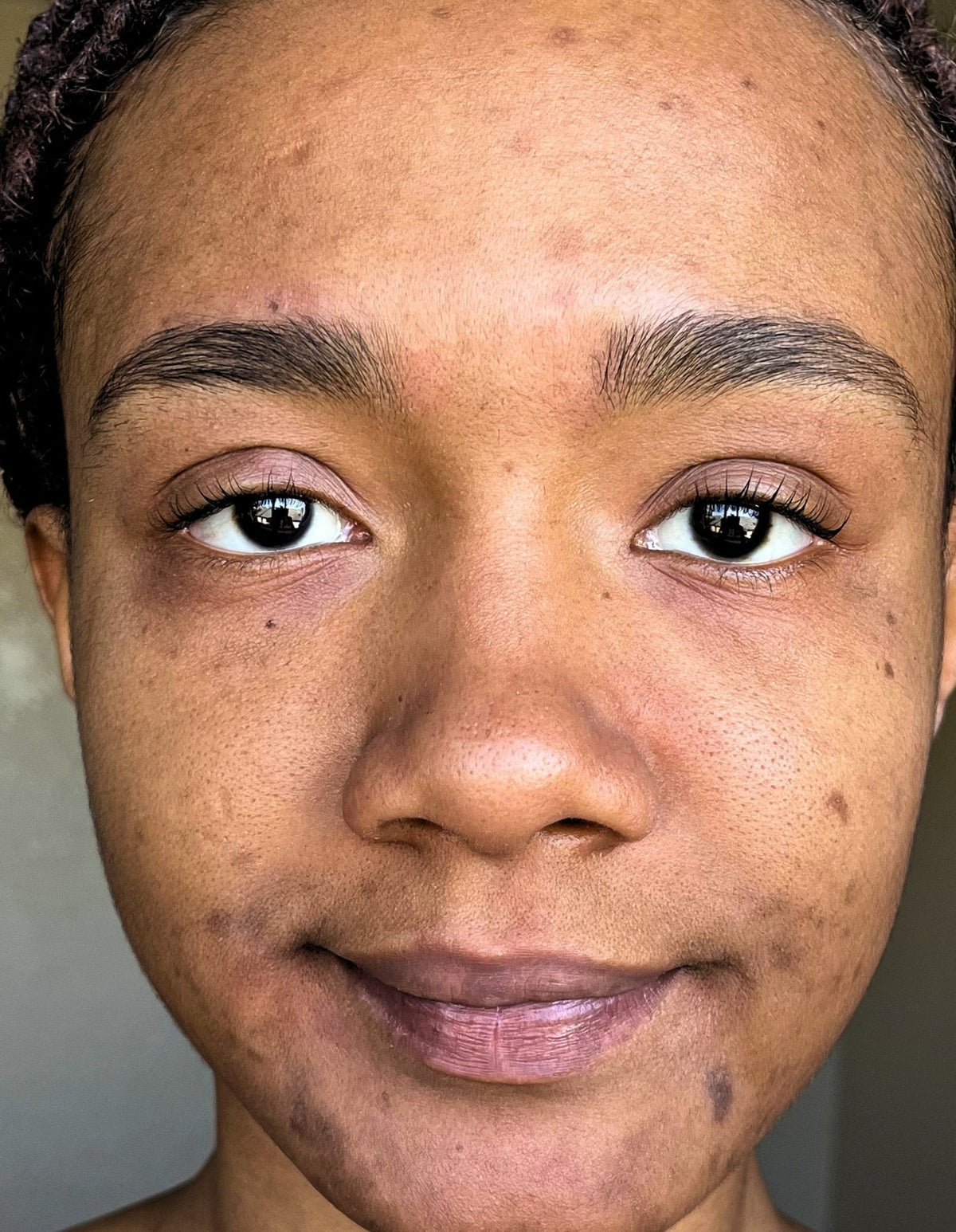 Deja before using LumaLux Face