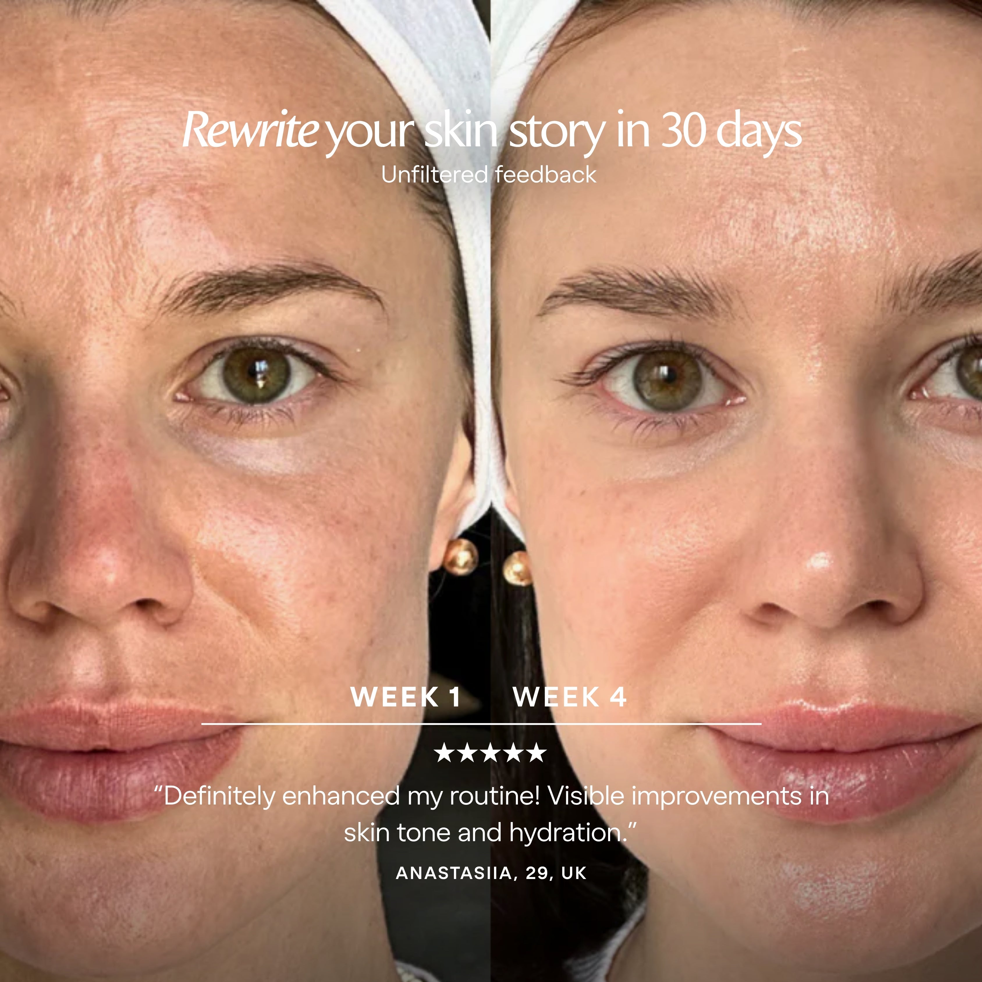 LumaLux Face | Pro LED Red Light Therapy Mask - Project E Beauty