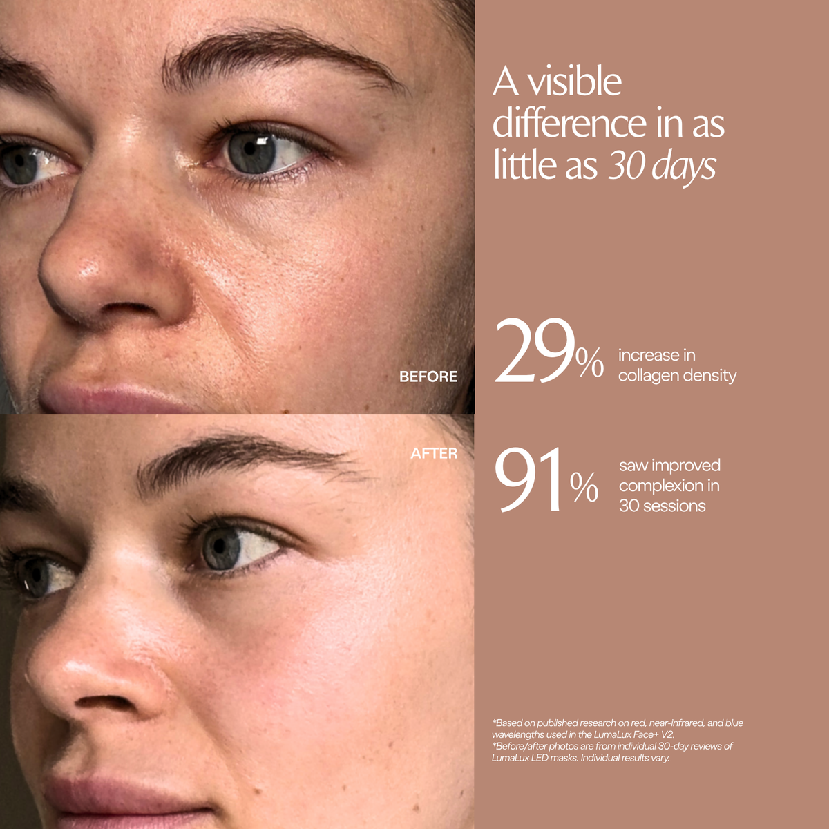 LumaLux Face+ V2 klantbeoordeling met voor-en-na-gezichtsfoto's en onderzoekspercentages
