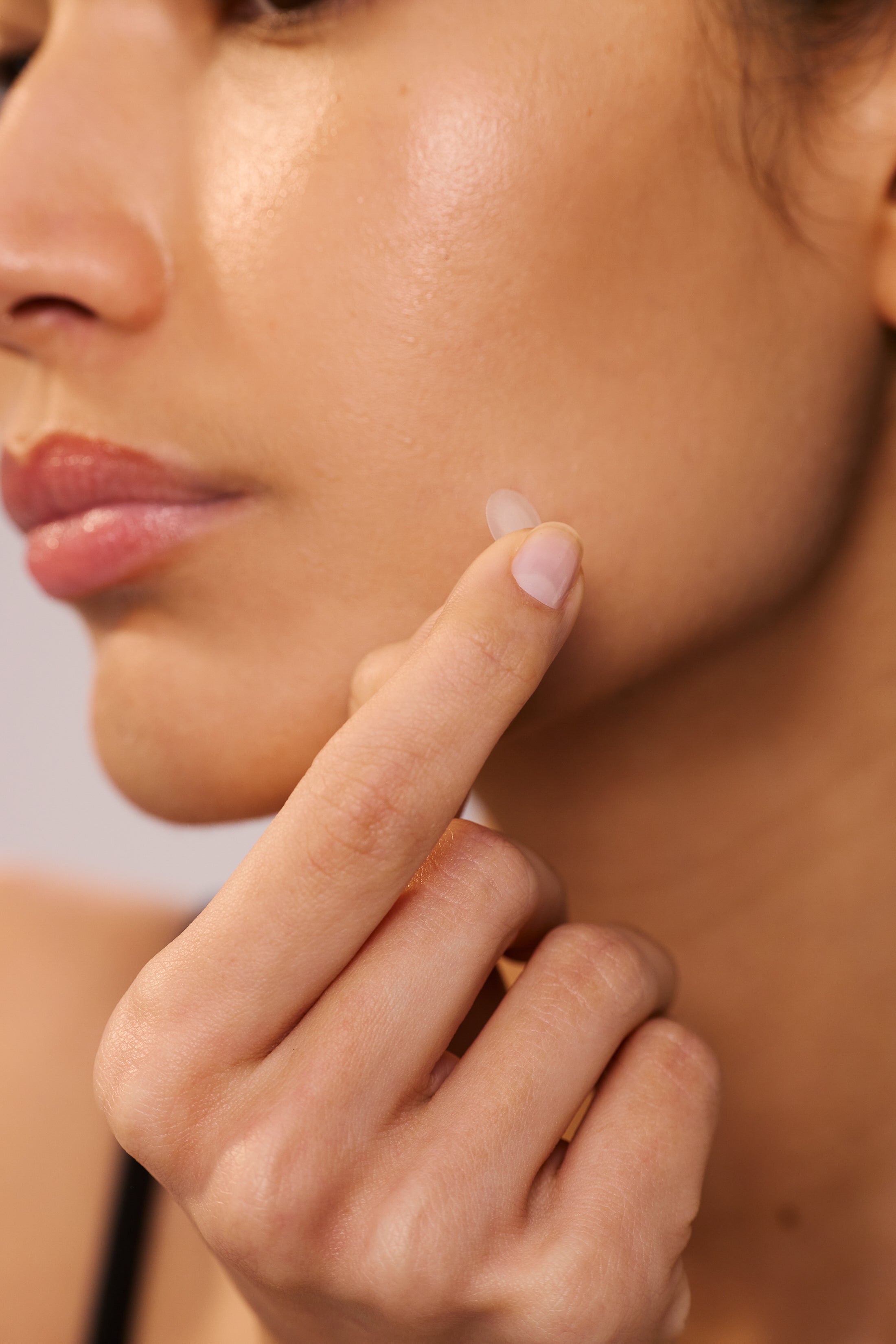 Hydrocollid acne patches designed to repair skin wounds, prevent scarring and reduce redness